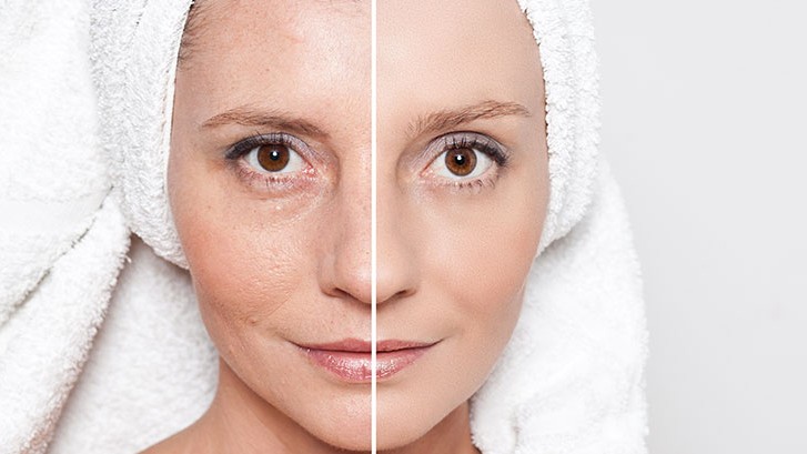 4 veci, vďaka ktorým vaša pokožka starne rýchlejšie